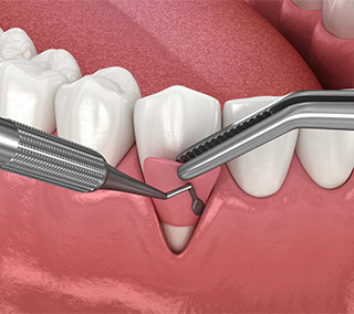 انواع جراحی های دهان و دندان